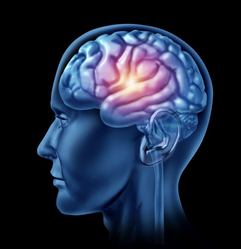 Home Health Care in Aventura FL: Traumatic Brain Injury