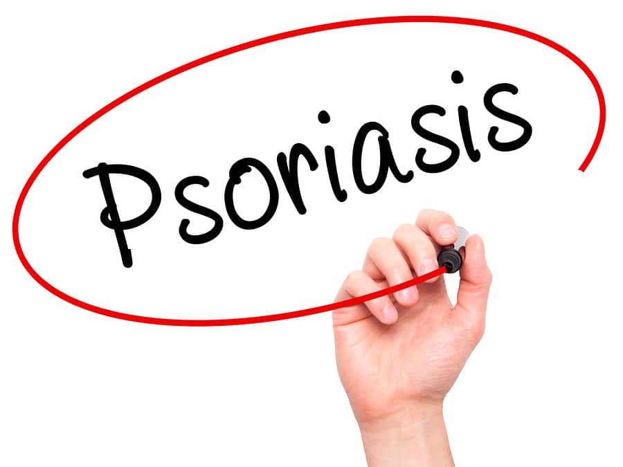 Personal Care Deerfield Beach FL - Tips That Can Help Seniors With Psoriasis